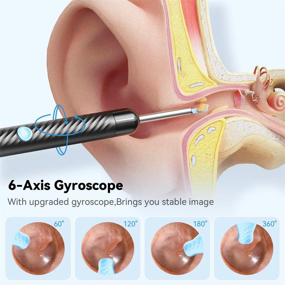 2026 - Ear Wax Removal