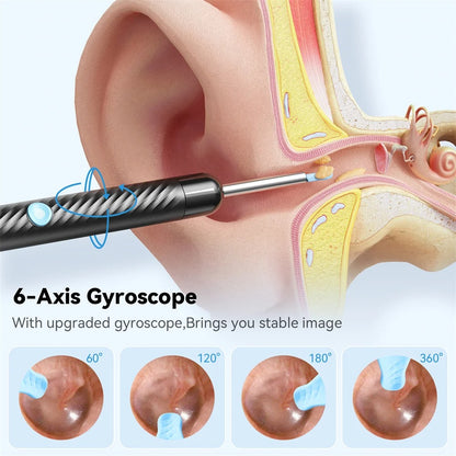 2026 - Ear Wax Removal